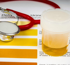 Urinary Health - Colors of Urine