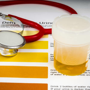 Urinary Health - Colors of Urine